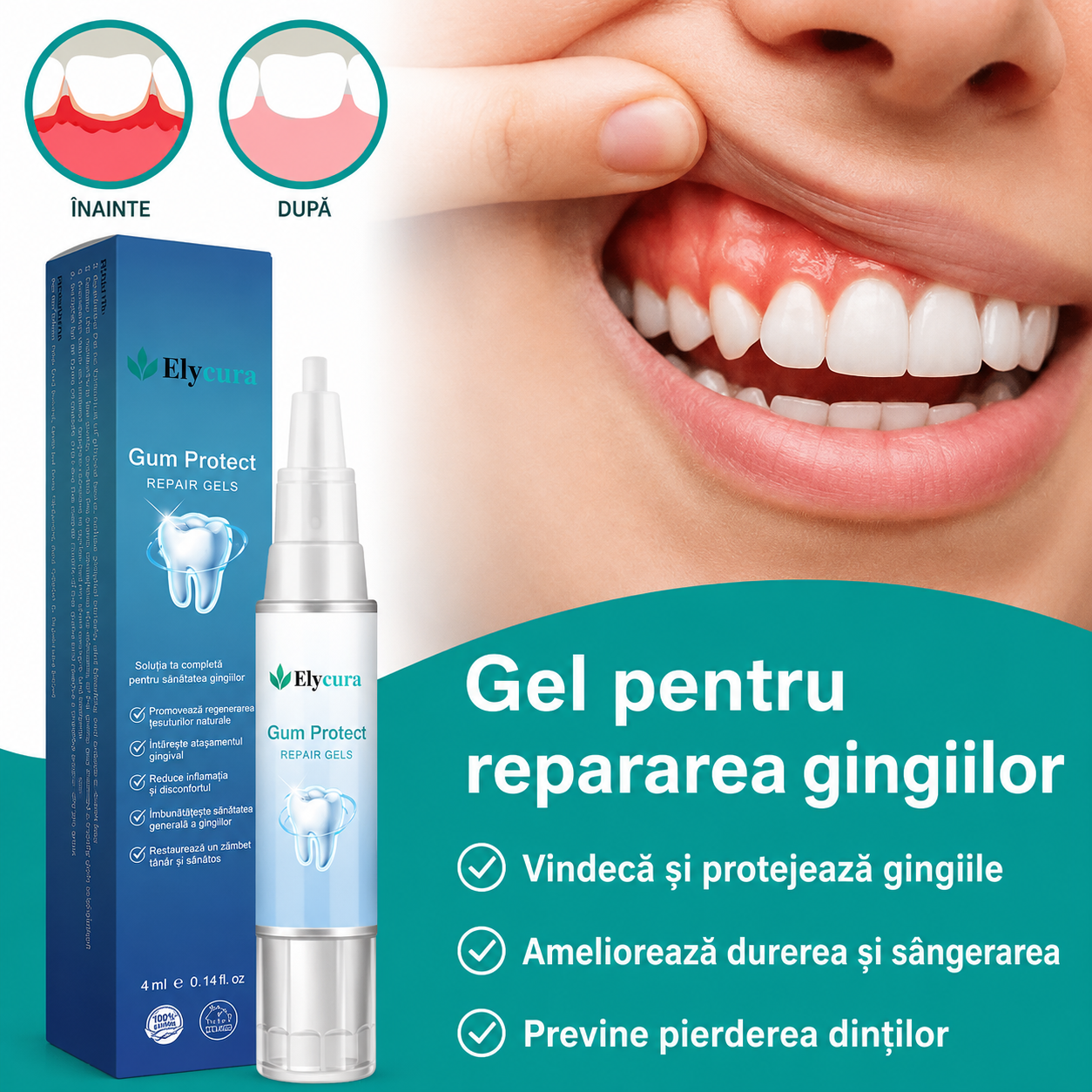 Elycura™ — Oprește retracția gingivală și sângerarea fără intervenții chirurgicale dureroase.